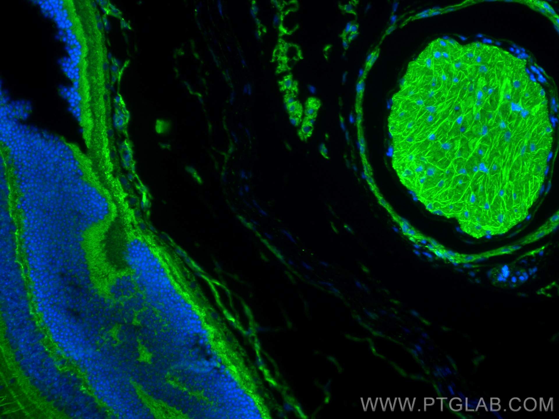 IF Staining of mouse eye using 27453-1-AP