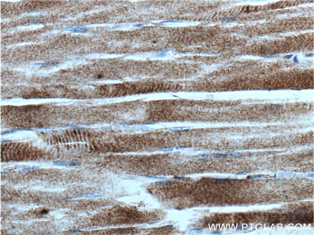IHC staining of human skeletal muscle using 27453-1-AP