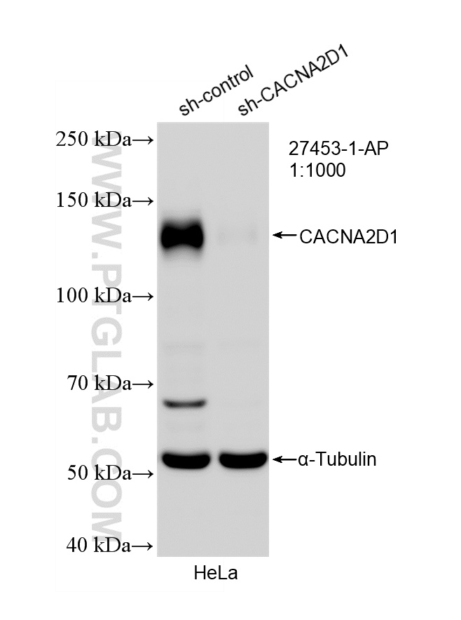 WB analysis of HeLa using 27453-1-AP