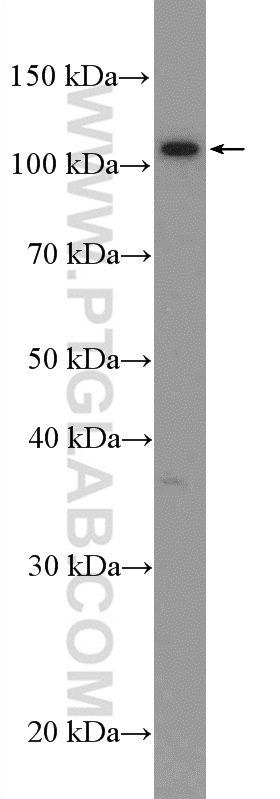 WB analysis of mouse brain using 21711-1-AP