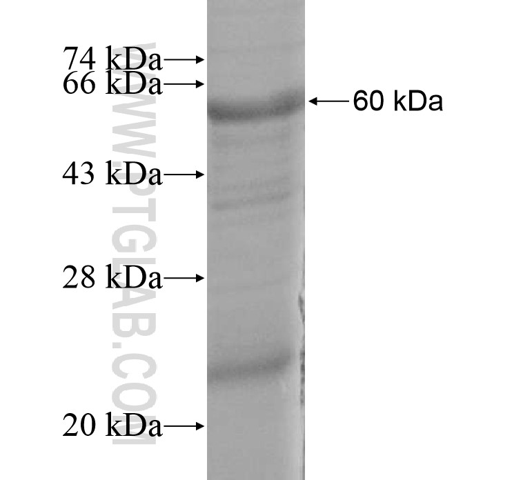 CACNA2D3 fusion protein Ag16337 SDS-PAGE