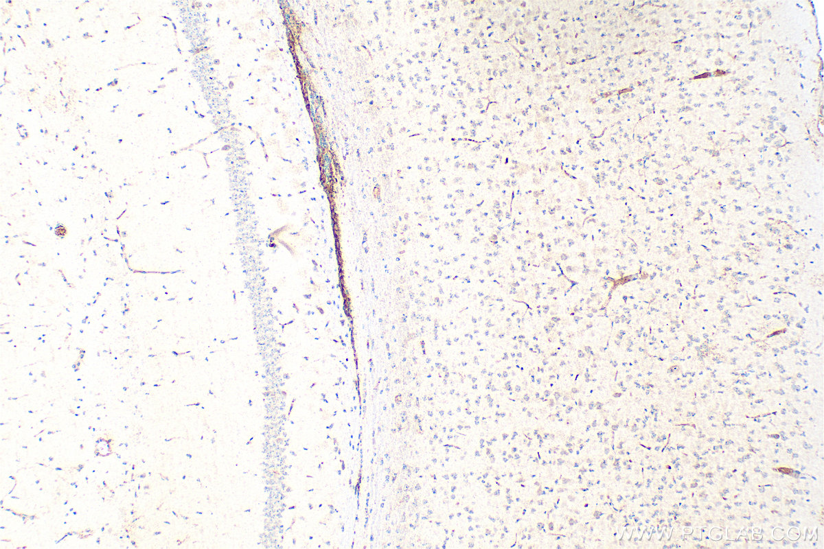 IHC staining of mouse brain using 26674-1-AP