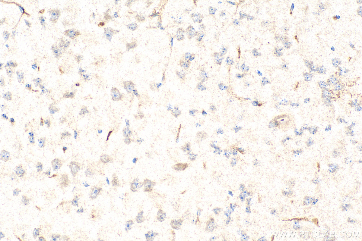 IHC staining of mouse brain using 26674-1-AP