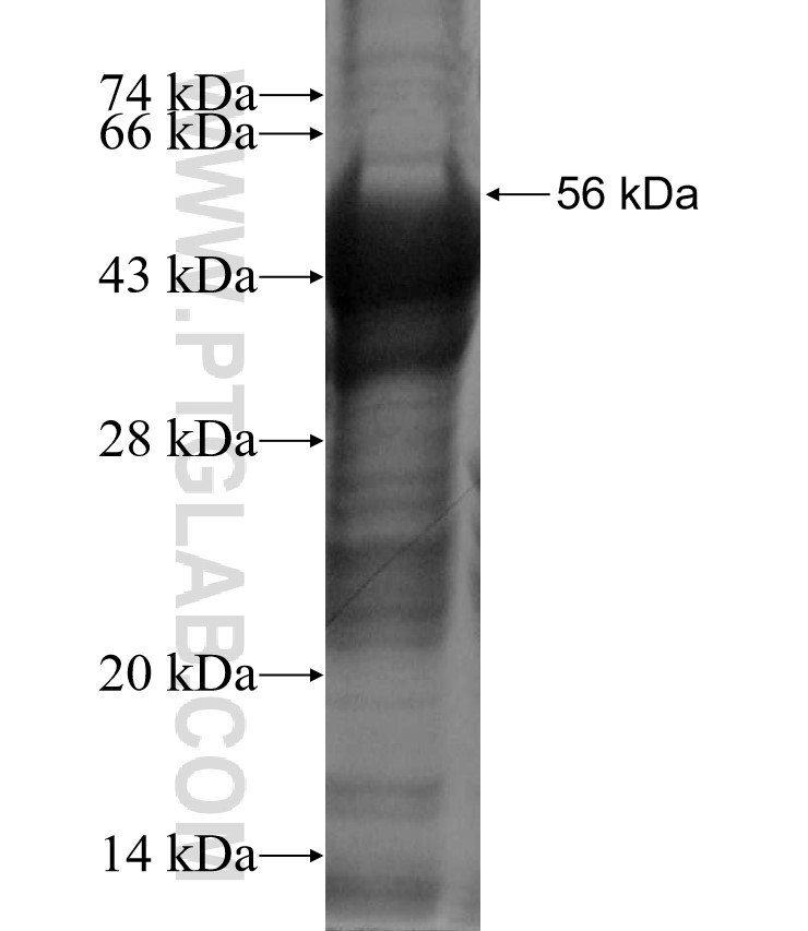 CACNB1 fusion protein Ag3693 SDS-PAGE
