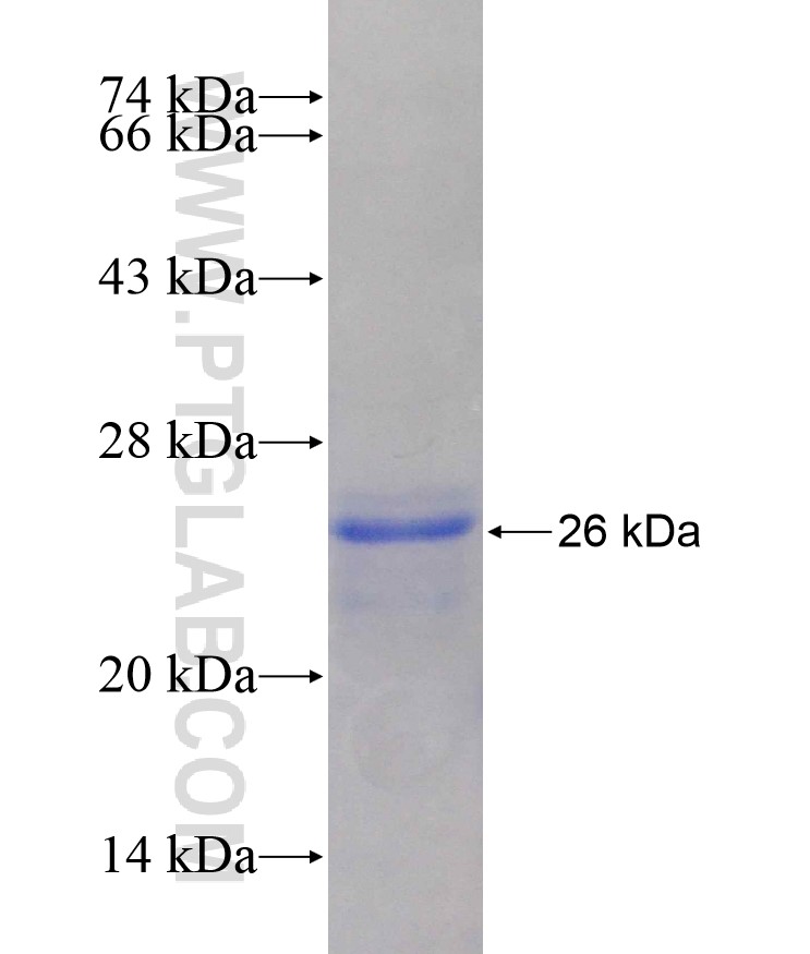 CACNB2 fusion protein Ag17989 SDS-PAGE