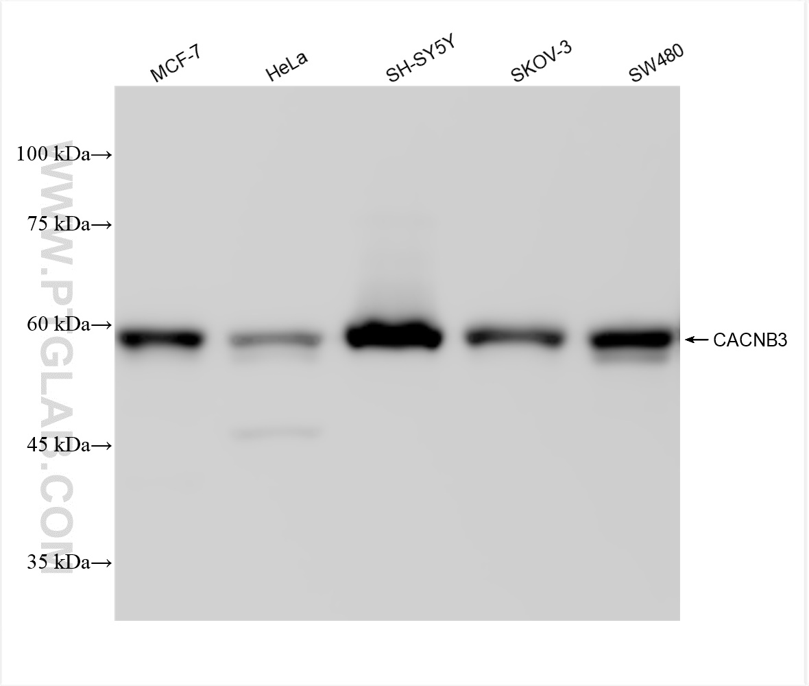 WB analysis using 84762-3-RR (same clone as 84762-3-PBS)