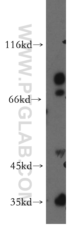 WB analysis of SH-SY5Y using 18498-1-AP