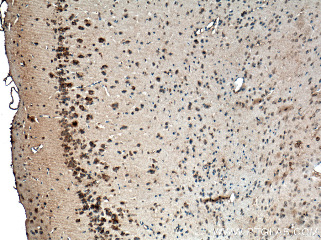 IHC staining of mouse brain using 17862-1-AP