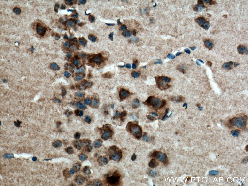 IHC staining of mouse brain using 17862-1-AP