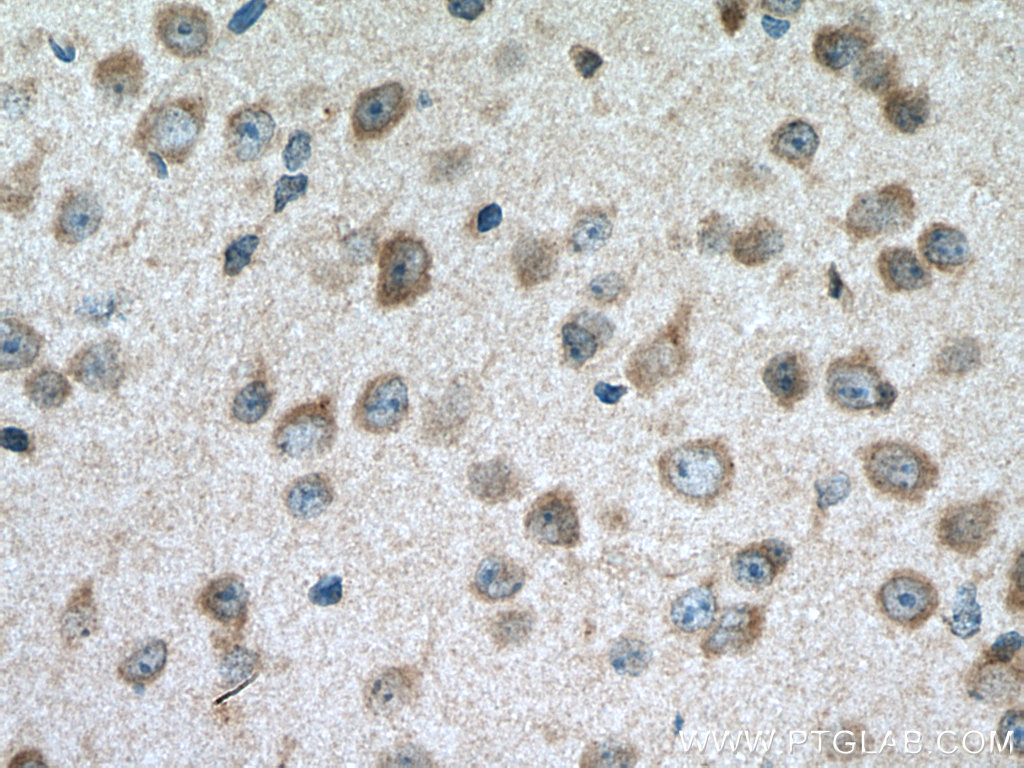 IHC staining of mouse brain using 55078-1-AP