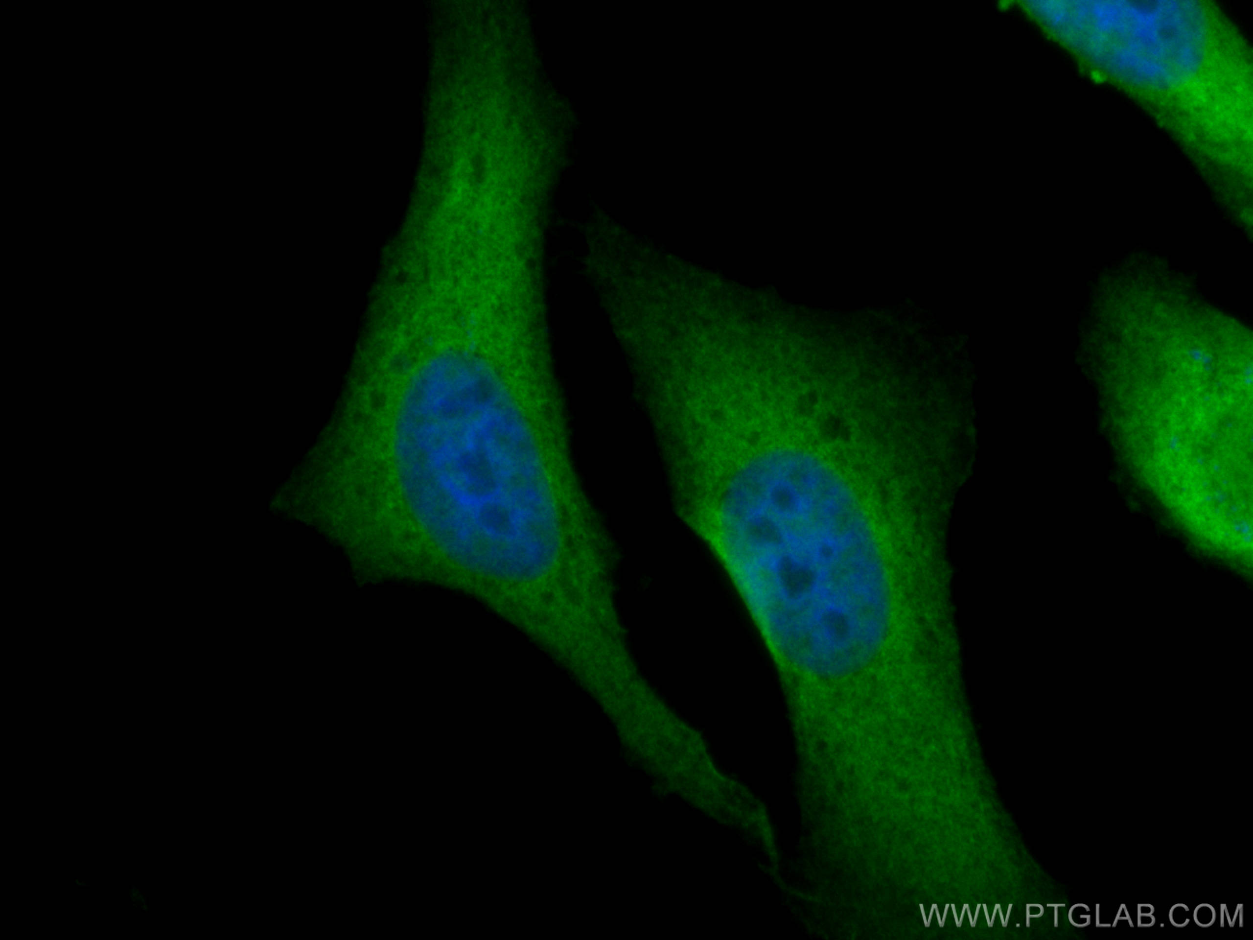 IF Staining of HeLa using 11745-1-AP (same clone as 11745-1-PBS)