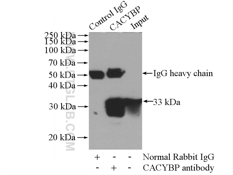 IP experiment of mouse brain using 11745-1-AP