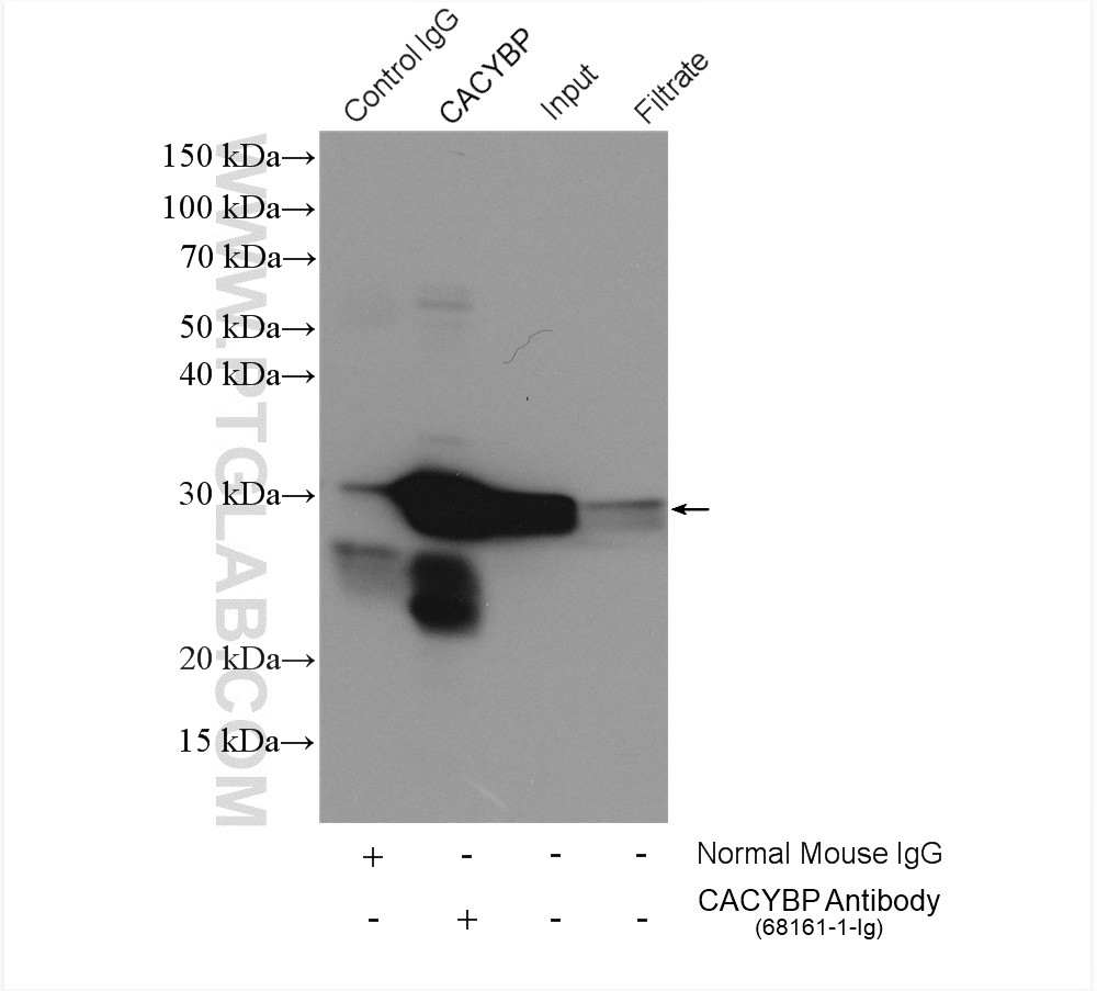 IP experiment of HeLa using 68161-1-Ig