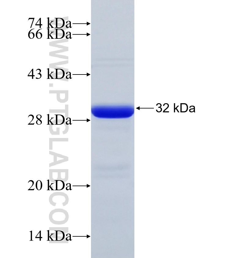 CACYBP fusion protein Ag32734 SDS-PAGE CACYBP fusion protein Ag32734 SDS-PAGE