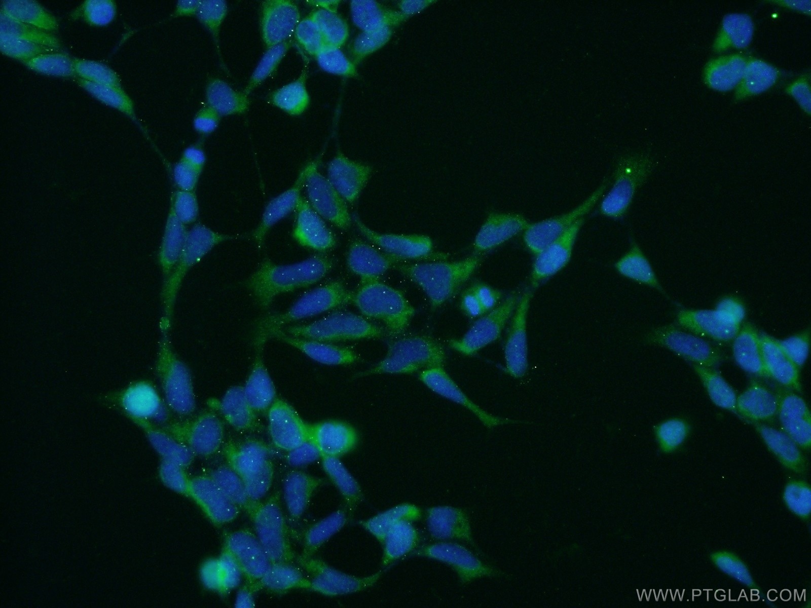 IF Staining of HEK-293 using 16617-1-AP (same clone as 16617-1-PBS)
