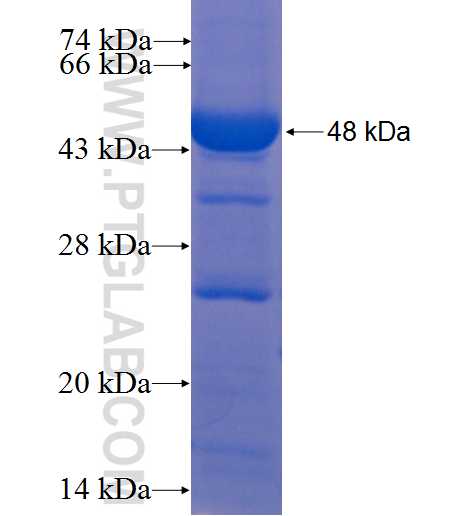 CAD fusion protein Ag9912 SDS-PAGE