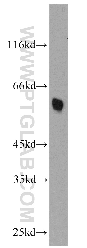 WB analysis of mouse liver using 14335-1-AP