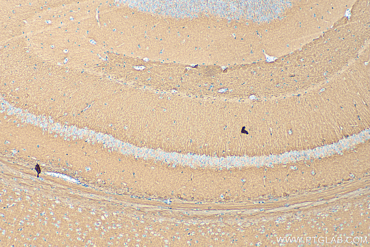 IHC staining of mouse brain using 17773-1-AP
