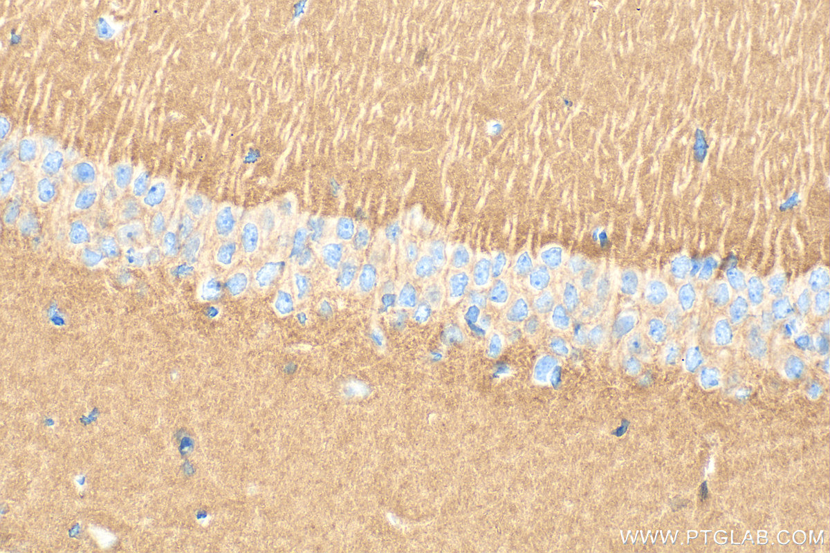 IHC staining of mouse brain using 17773-1-AP