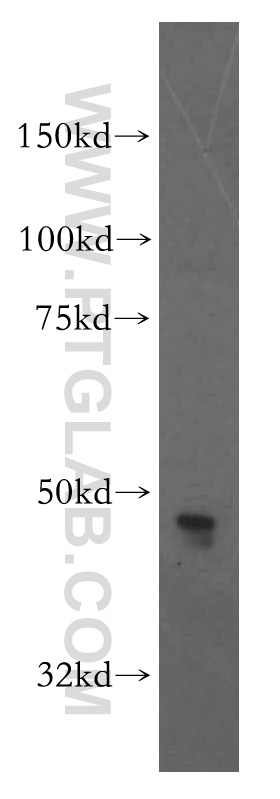 CADM3 Polyclonal antibody