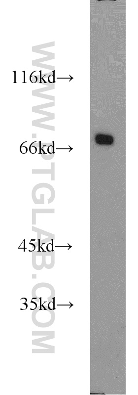 CADM4 Polyclonal antibody