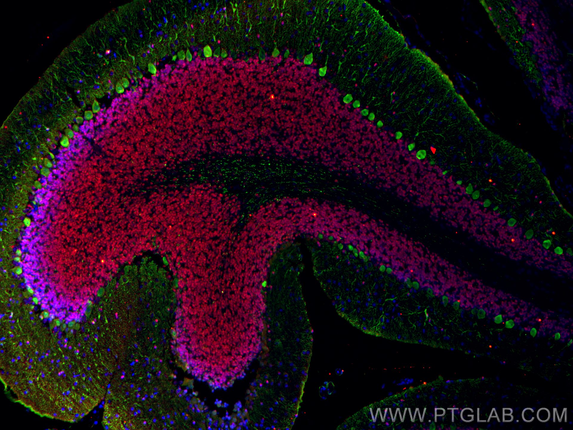 IF Staining of mouse cerebellum using 14479-1-AP