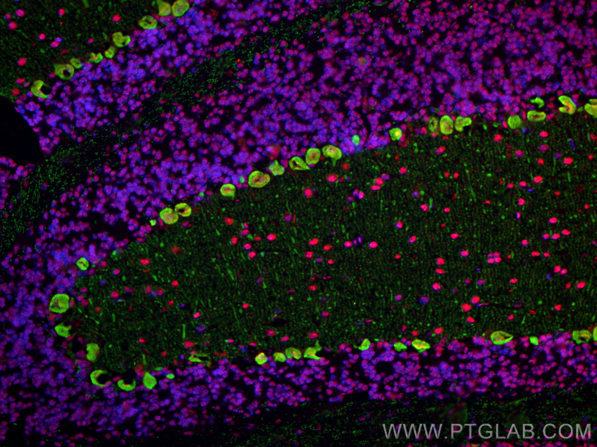 IF Staining of mouse cerebellum using 14479-1-AP