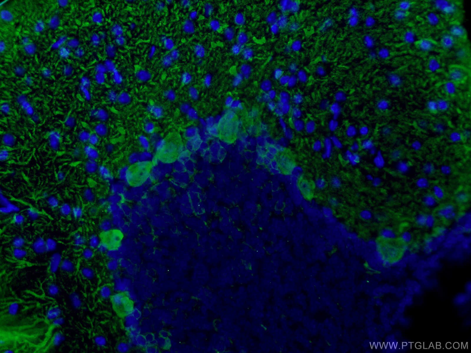IF Staining of mouse cerebellum using 14479-1-AP