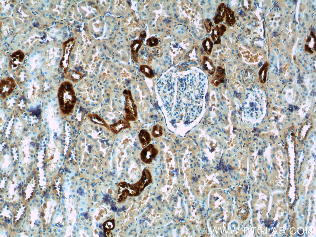 Calbindin (D12) Rabbit mAb main image 1