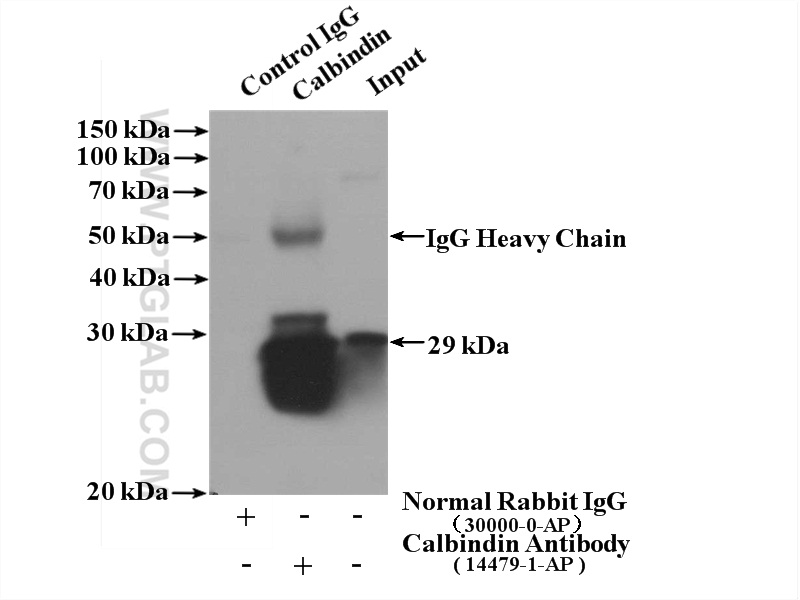 IP experiment of mouse brain using 14479-1-AP