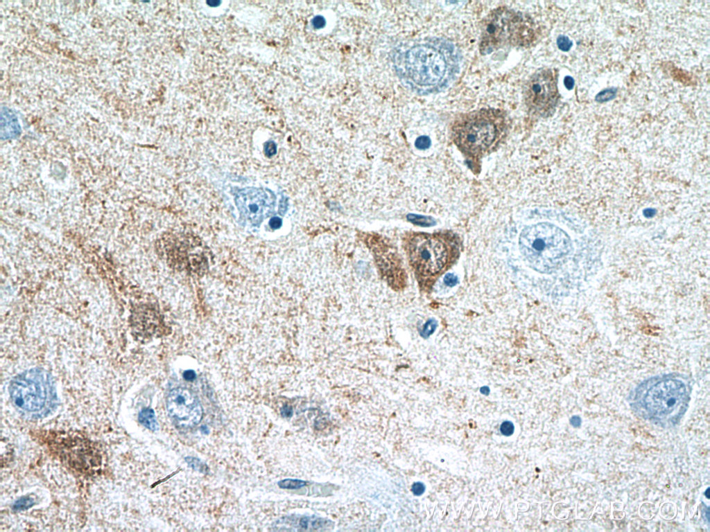 Calretinin Polyclonal antibody