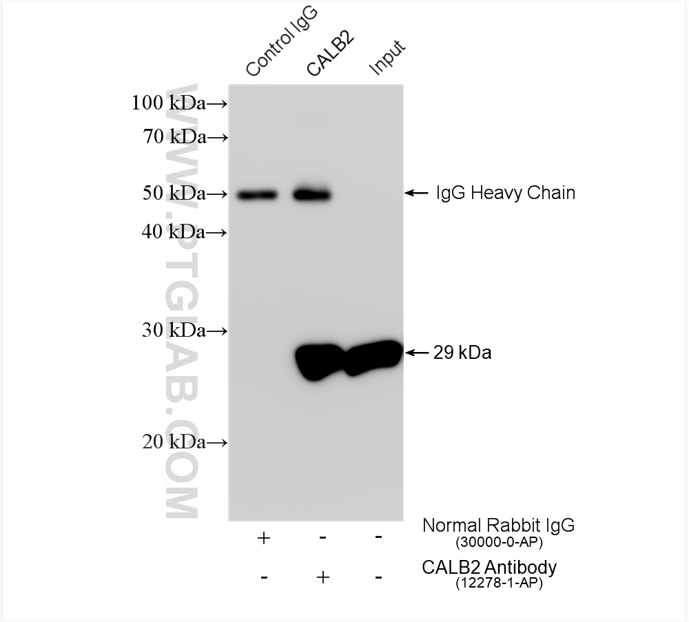 IP experiment of mouse brain using 12278-1-AP