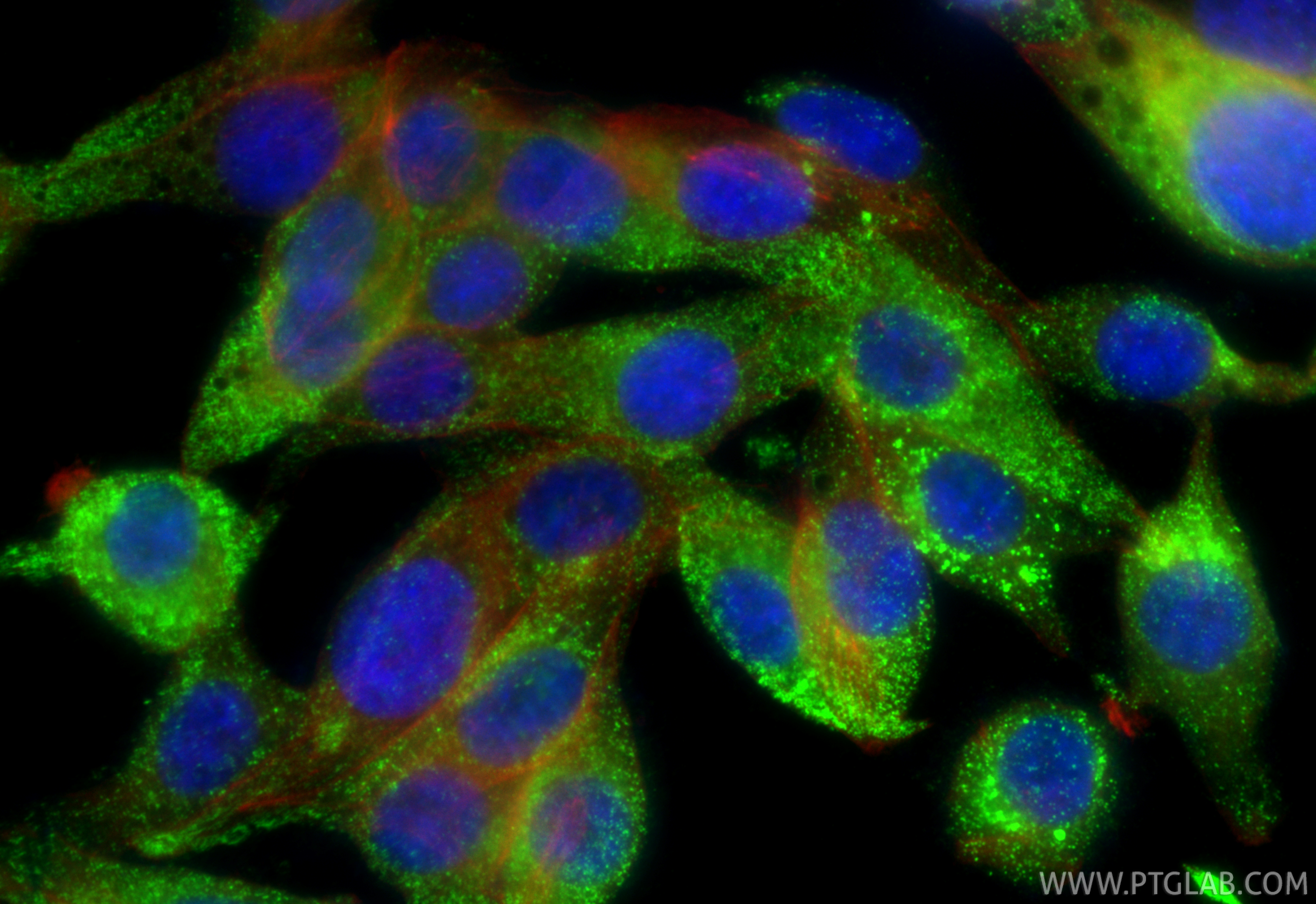 IF Staining of TT using 22244-1-AP