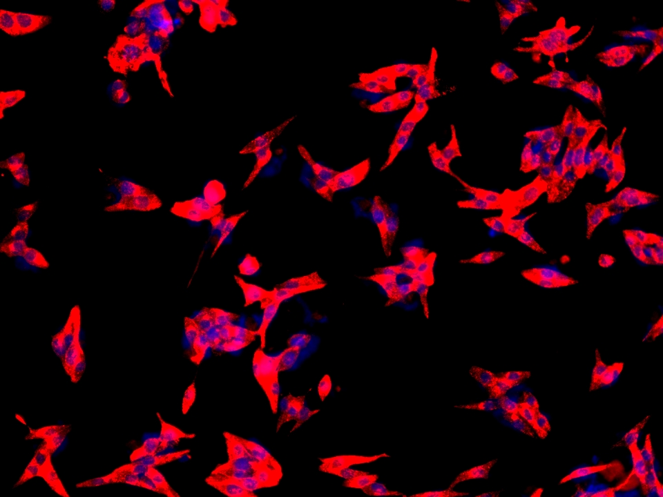 CALCA/CGRP