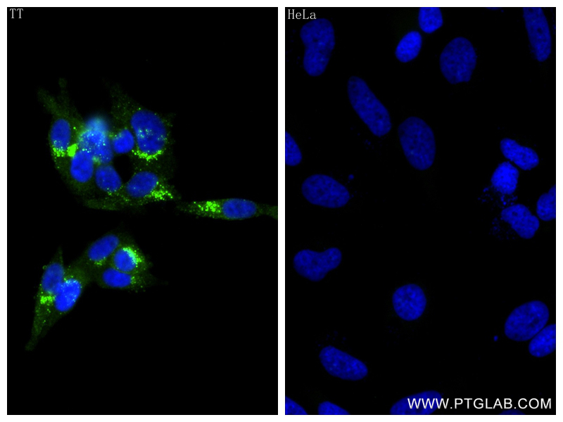 IF Staining of TT using 83774-1-RR (same clone as 83774-1-PBS)