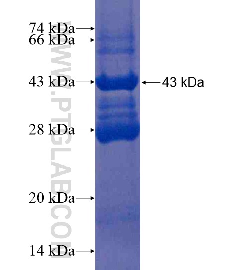 CALCA fusion protein Ag21503 SDS-PAGE