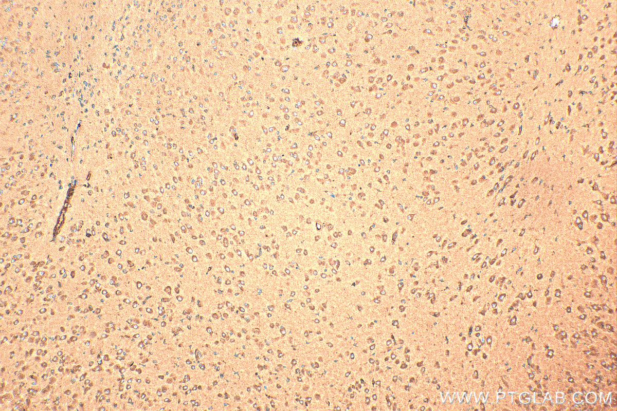 IHC staining of mouse brain using 23890-1-AP