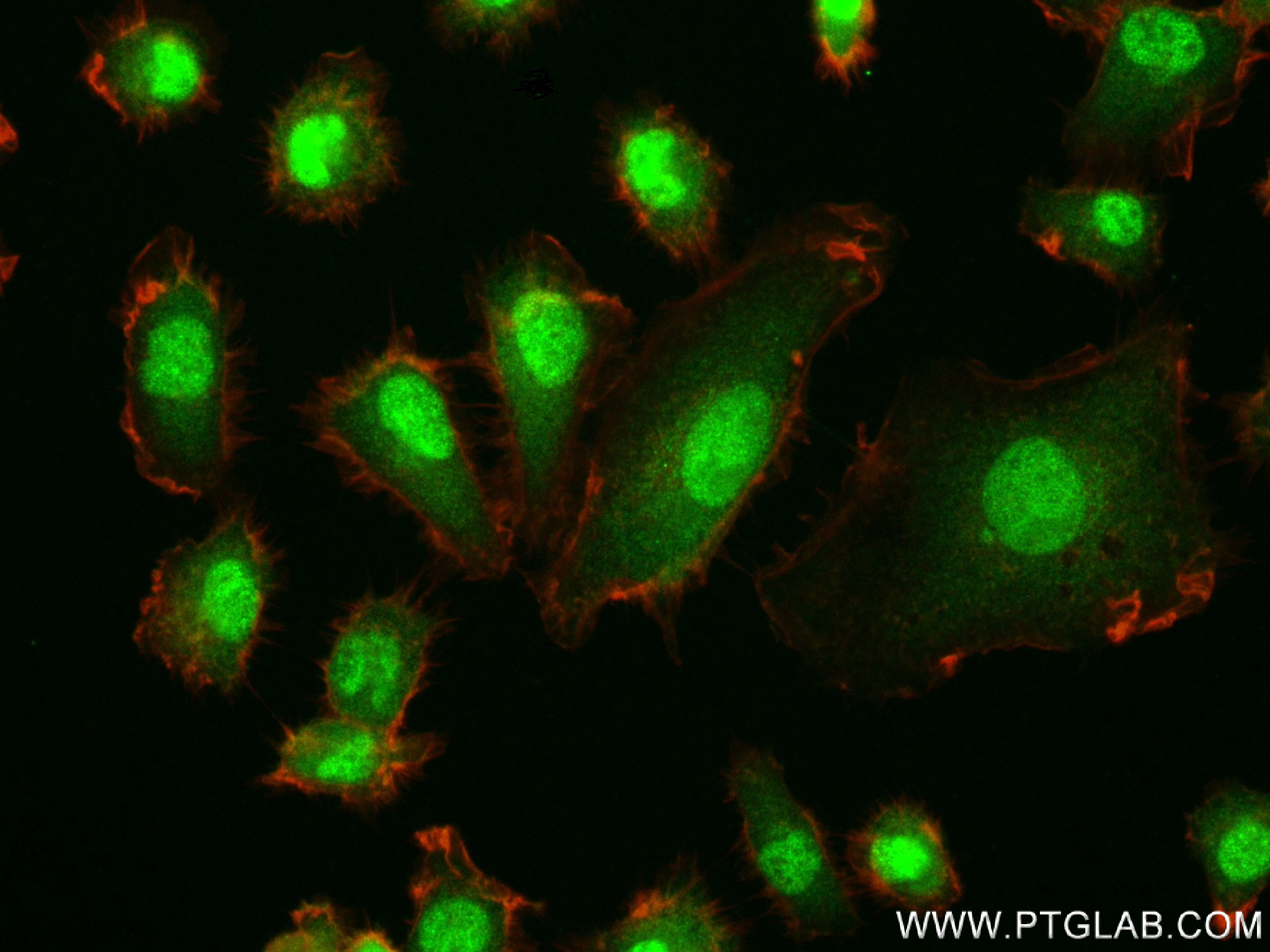 IF Staining of HT-1080 using 84009-5-RR