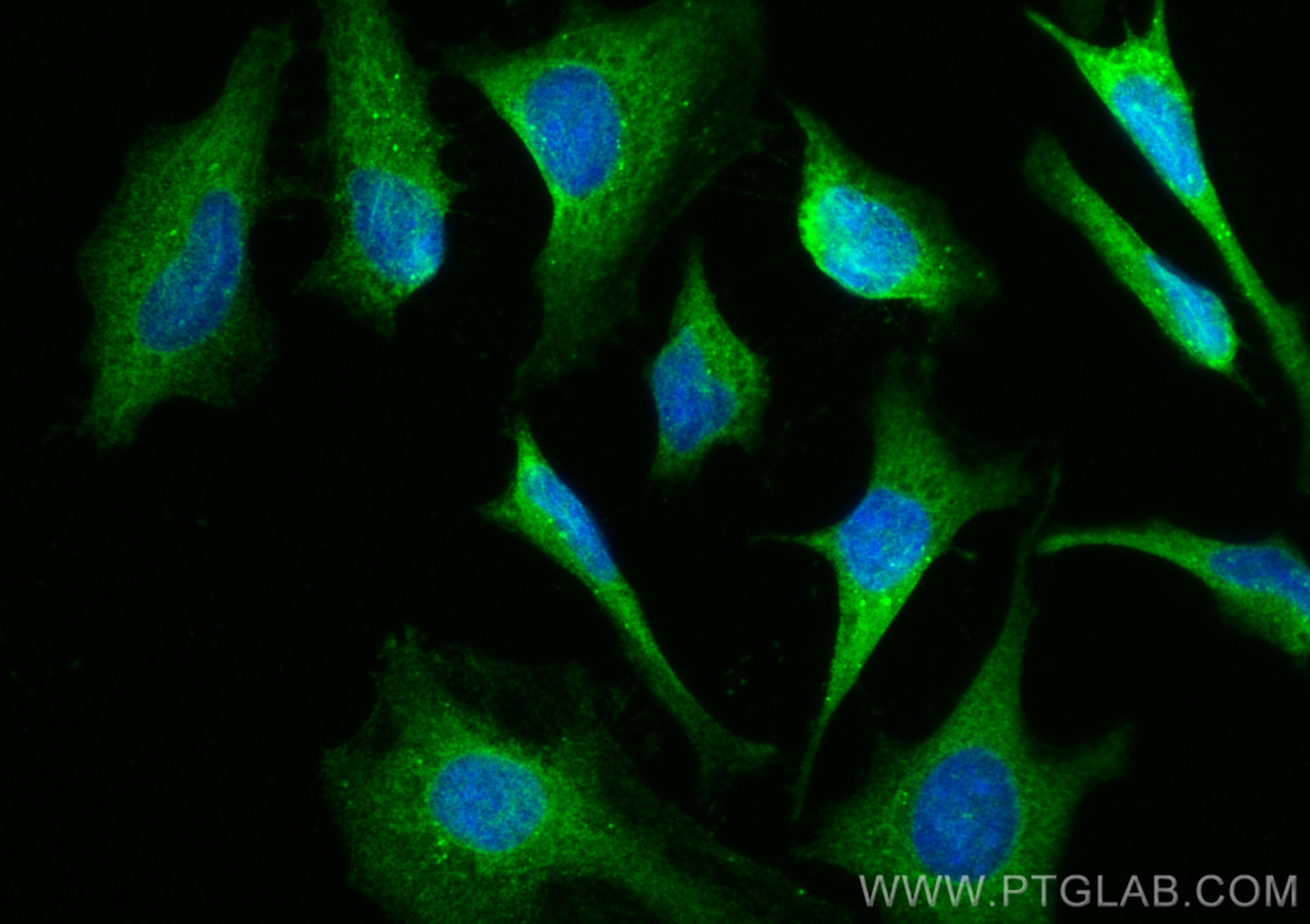 IF Staining of HeLa using 12229-1-AP