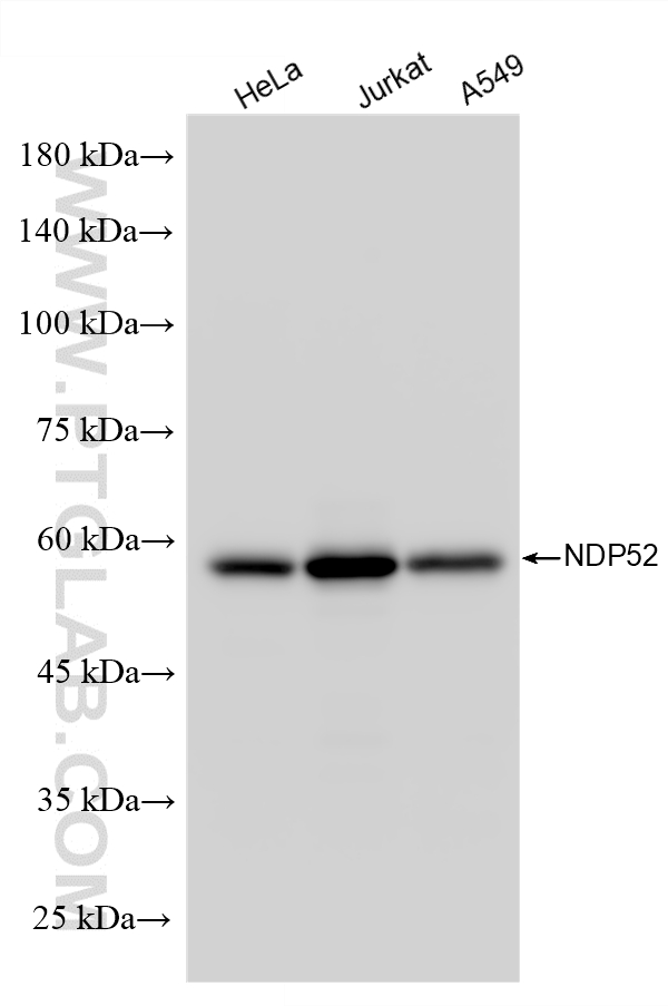 Various lysates were subjected to SDS PAGE followed by western blot with 12229-1-AP (NDP52 antibody) at dilution of 1:10000 incubated at room temperature for 1.5 hours. WB analysis using 12229-1-AP