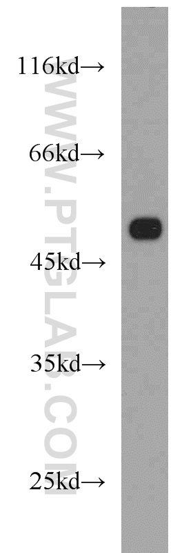 NDP52 Polyclonal antibody