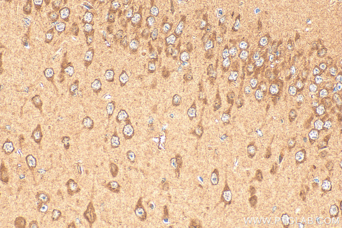 Immunohistochemical analysis of paraffin-embedded mouse brain tissue slide using 66401-1-Ig (NDP52 antibody) at dilution of 1:200 (under 40x lens). Heat mediated antigen retrieval with Tris-EDTA buffer (pH 9.0). IHC staining of mouse brain using 66401-1-Ig