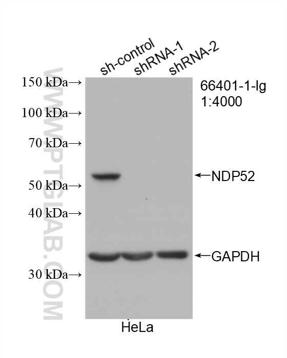 WB analysis of HeLa using 66401-1-Ig (same clone as 66401-1-PBS)