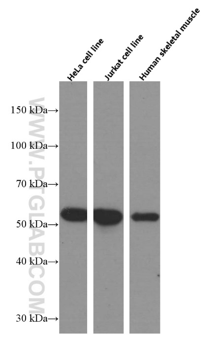 WB analysis of HeLa using 66401-1-Ig (same clone as 66401-1-PBS)