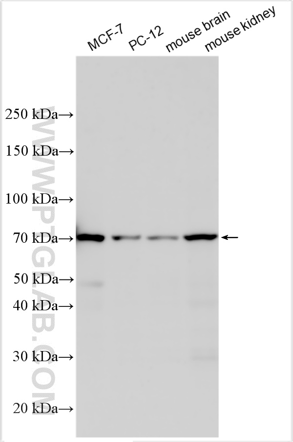 WB analysis using 20868-1-AP
