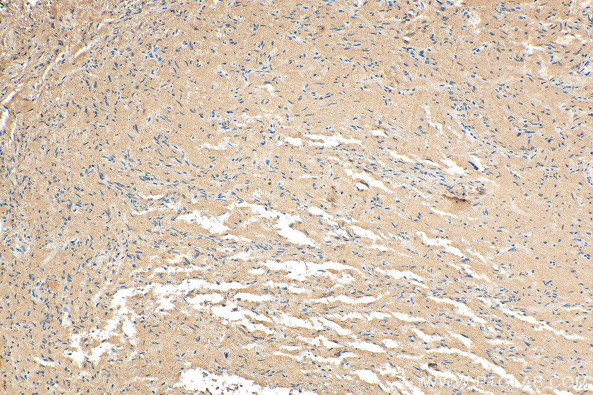 IHC staining of human pituitary using 13703-1-AP