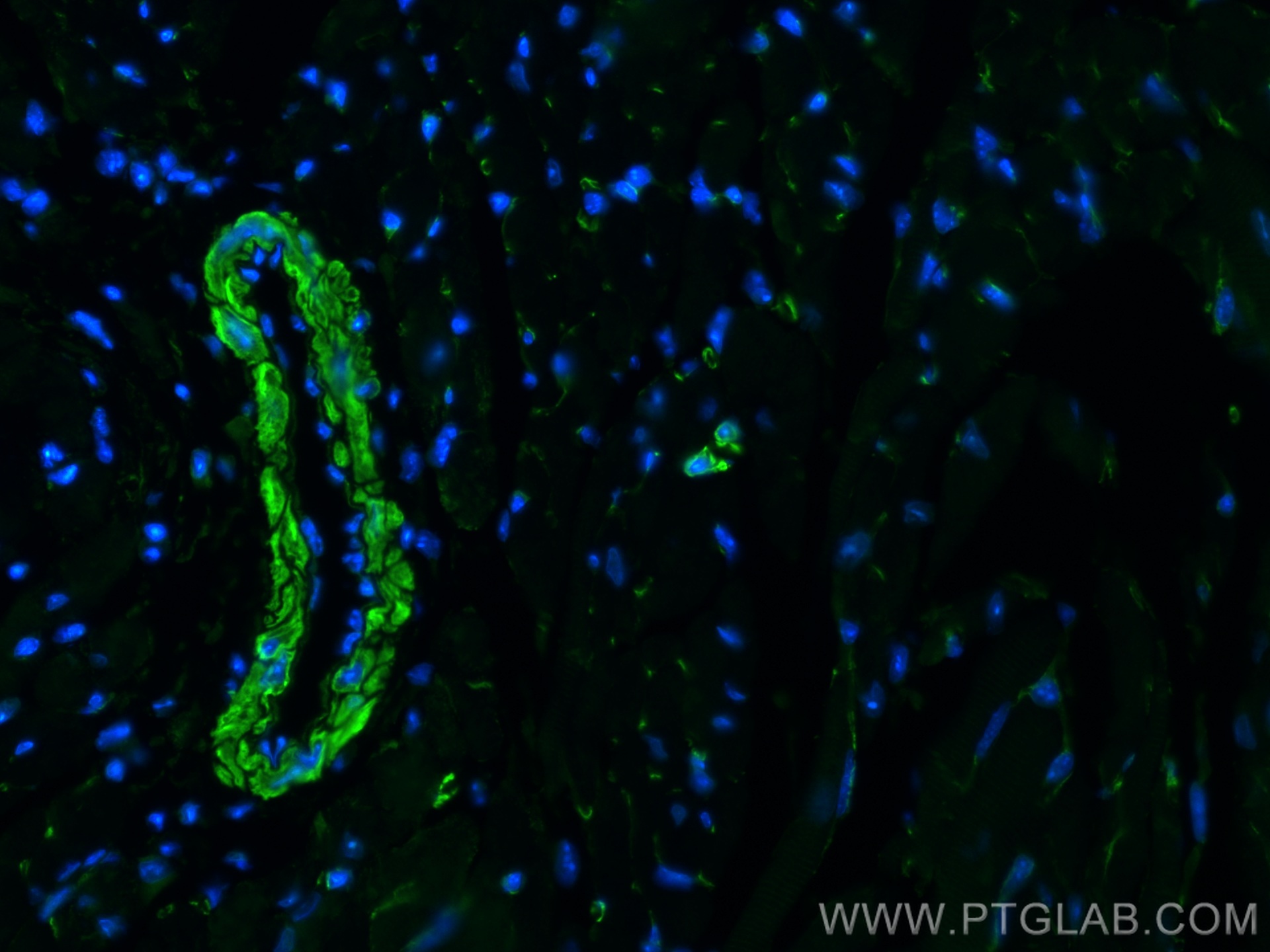 IF Staining of mouse heart using 20887-1-AP