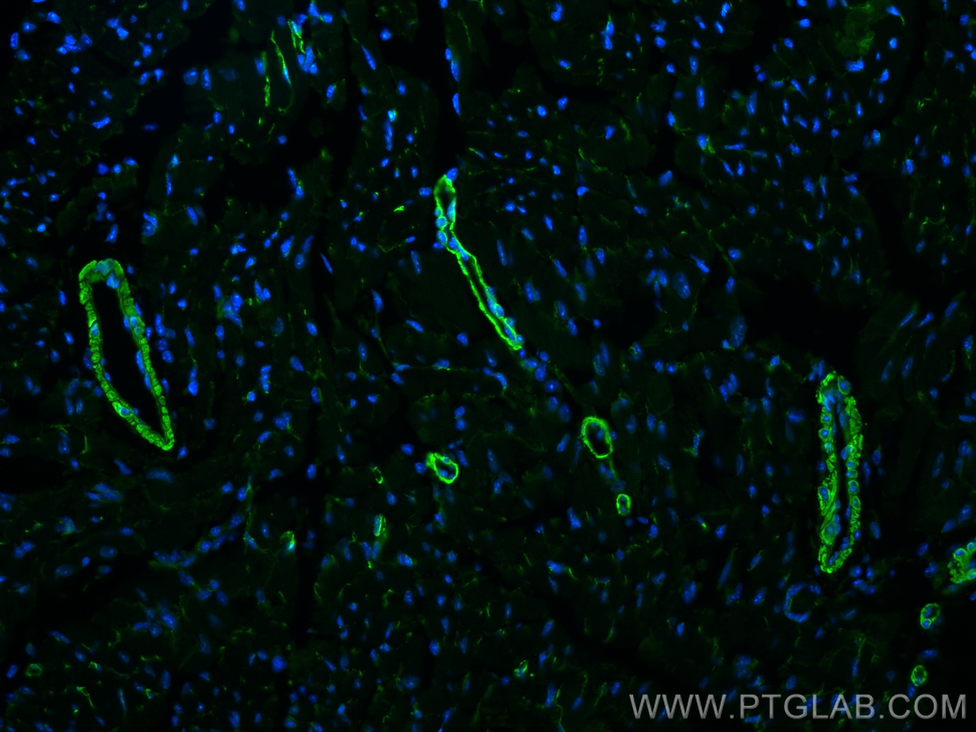 IF Staining of mouse heart using 20887-1-AP