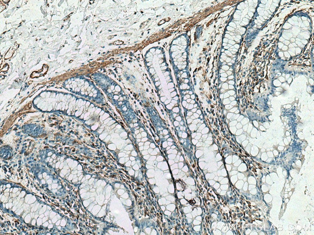 IHC staining of human colon using 20887-1-AP