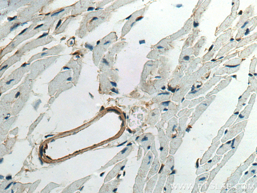 IHC staining of mouse heart using 20887-1-AP